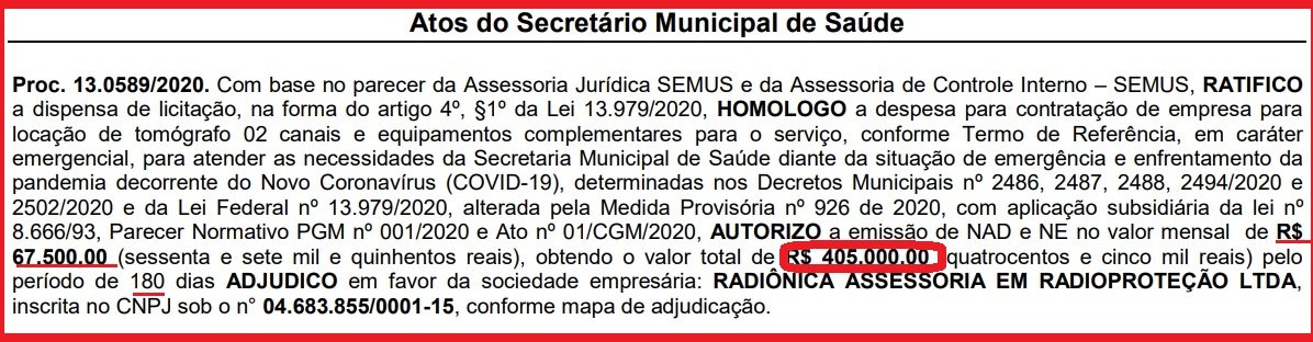 Saúde de Queimados aluga tomógrafo de empresa de reparo em computadores e vai pagar R$ 405 mil por seis meses de locação