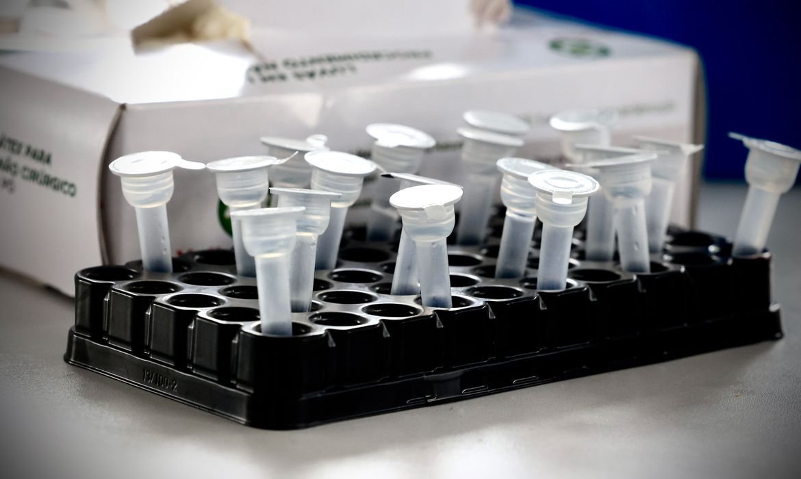 Rio de Janeiro começa a desmobilizar postos de testagem de covid-19